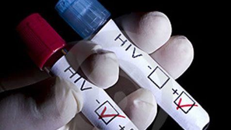 พิธีรำลึกวันโรคเอดส์สากล